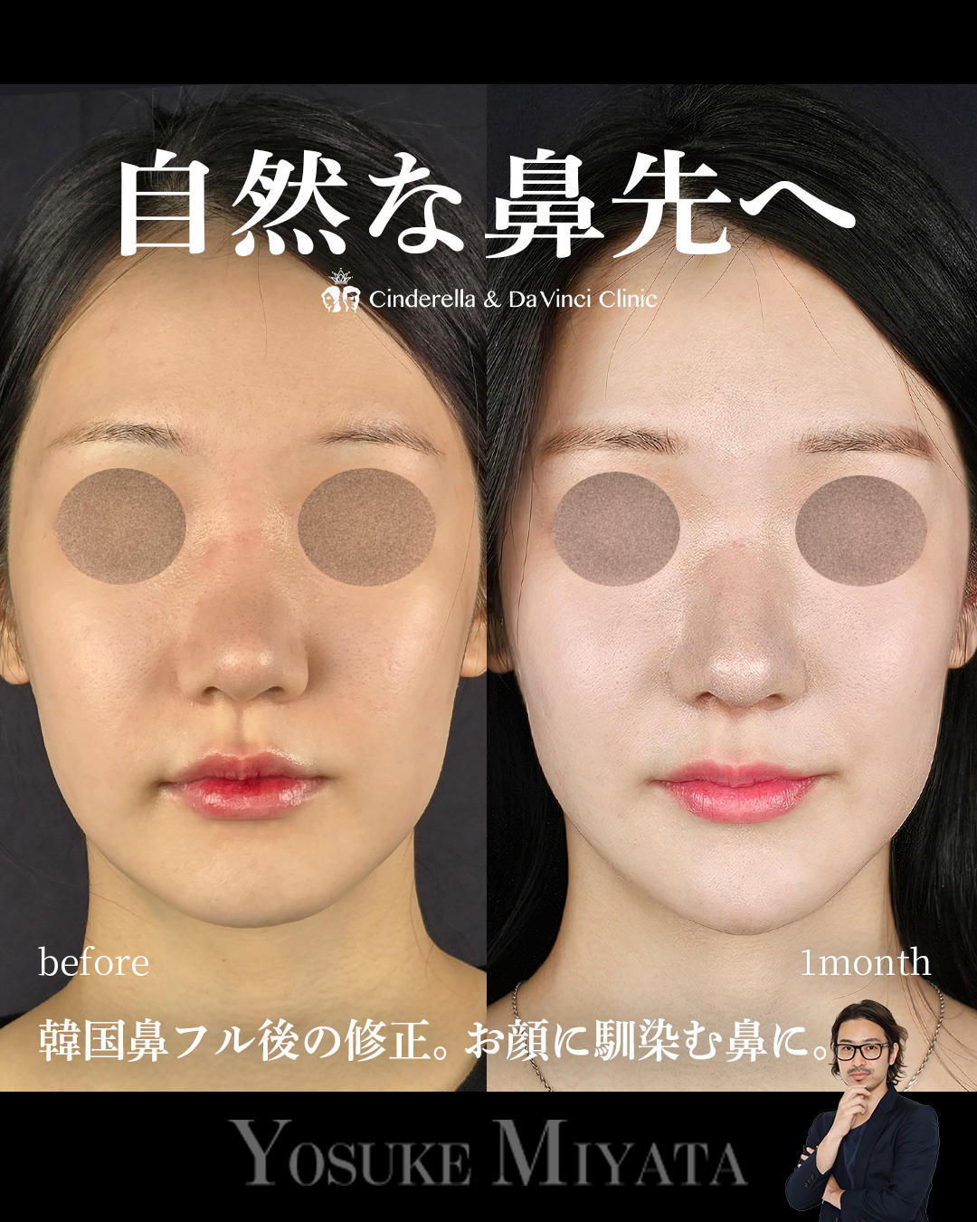自然な鼻先への画像