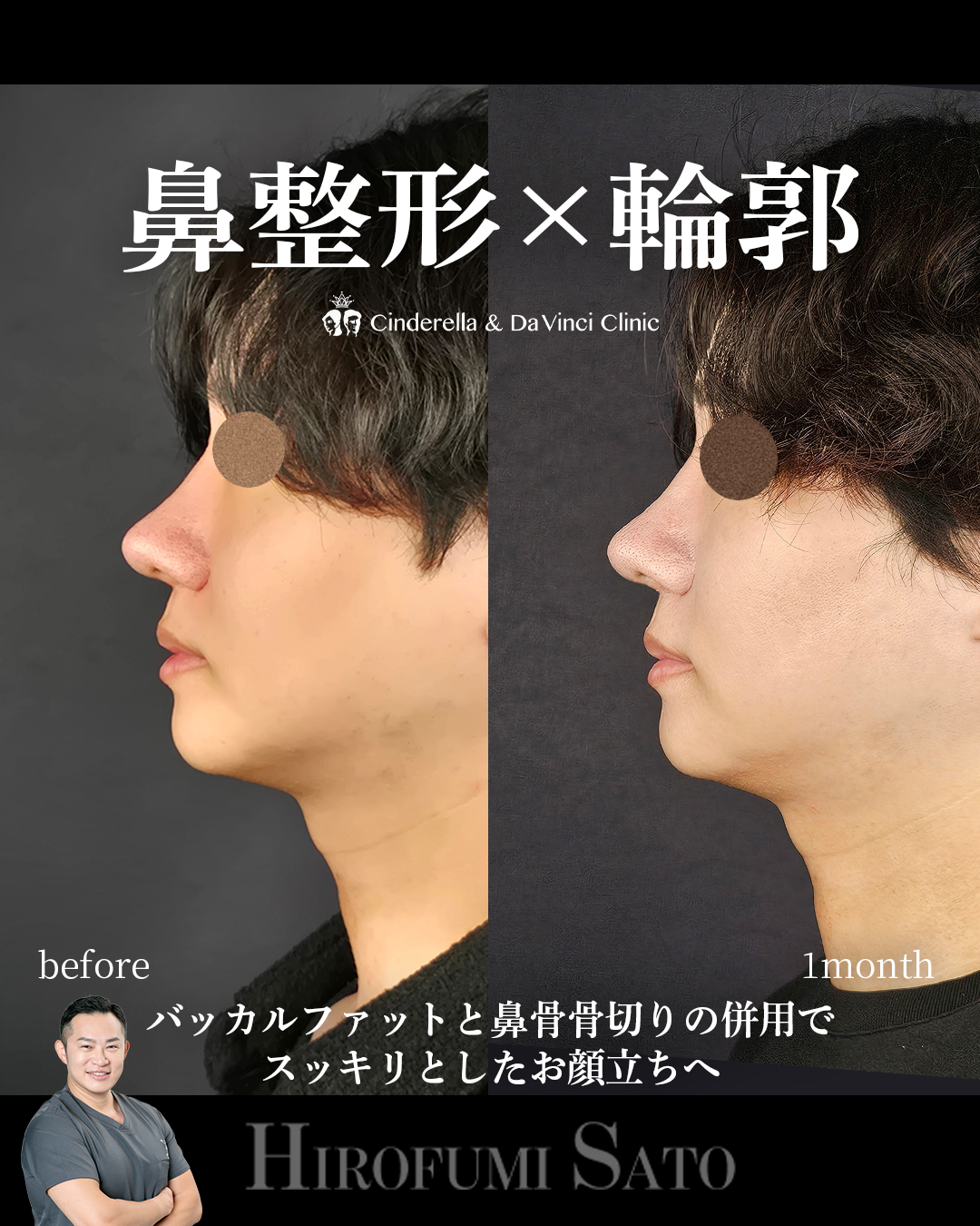 スッキリとした顔立ちへの画像