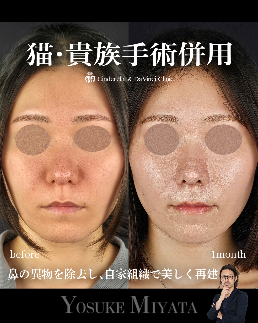 猫・貴族手術を含む他院修正の画像