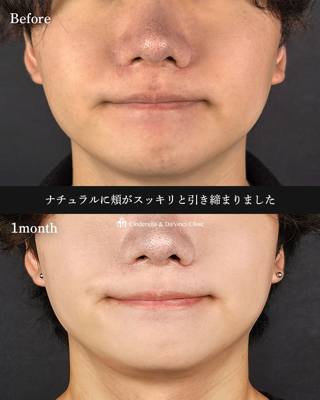 スッキリとした顔立ちへの画像