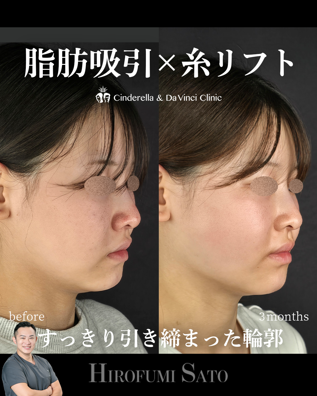 輪郭を引き締めるの画像