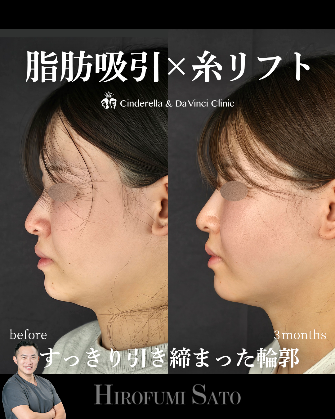 輪郭を引き締めるの画像