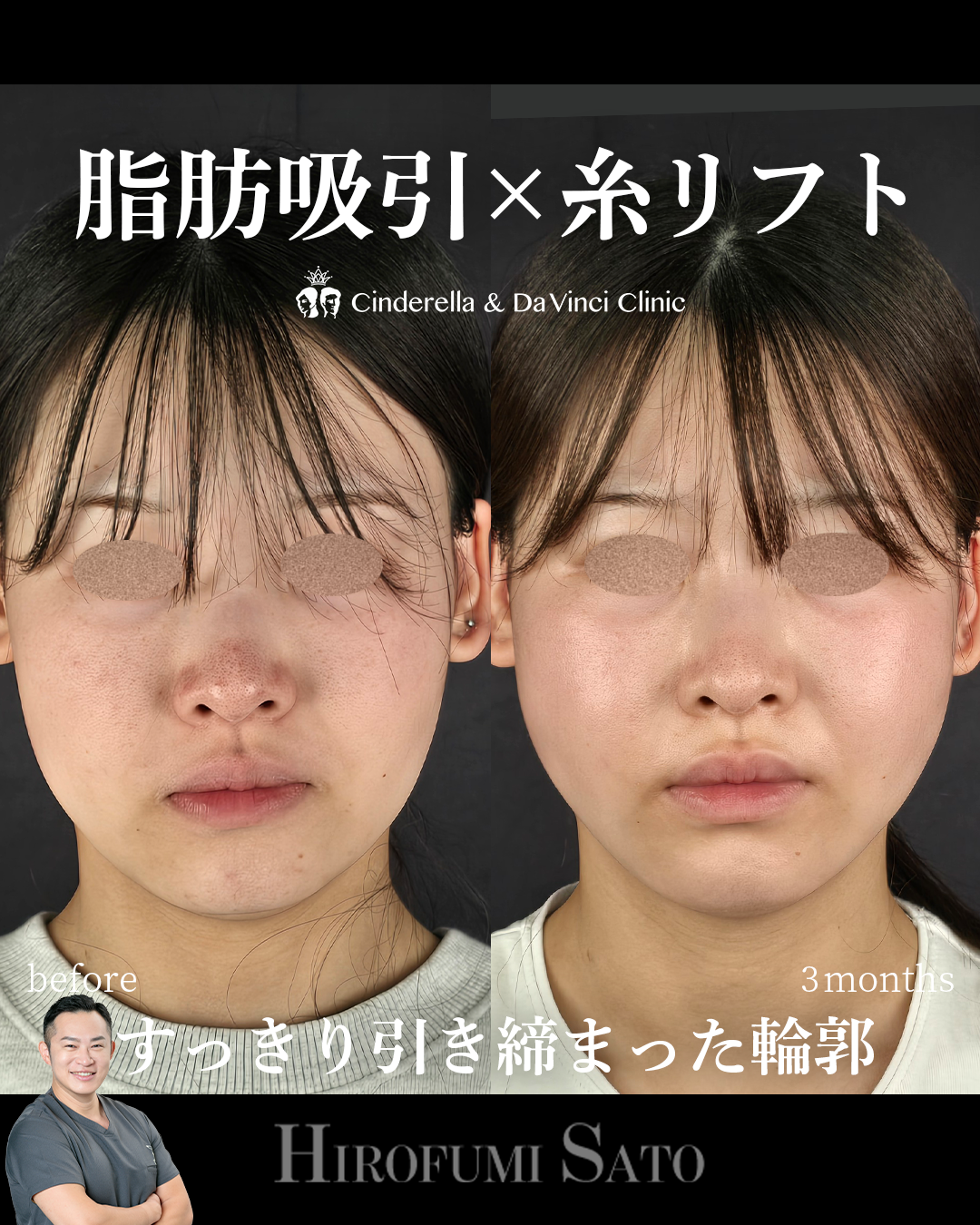 輪郭を引き締める