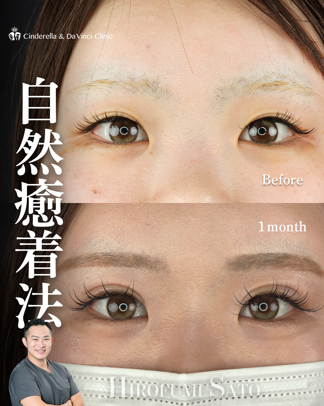 まつエクが映える二重