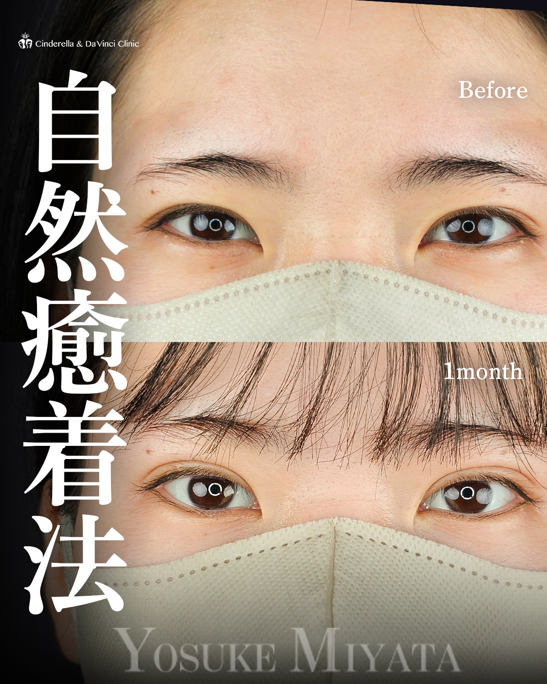 ぱっちり目元へ