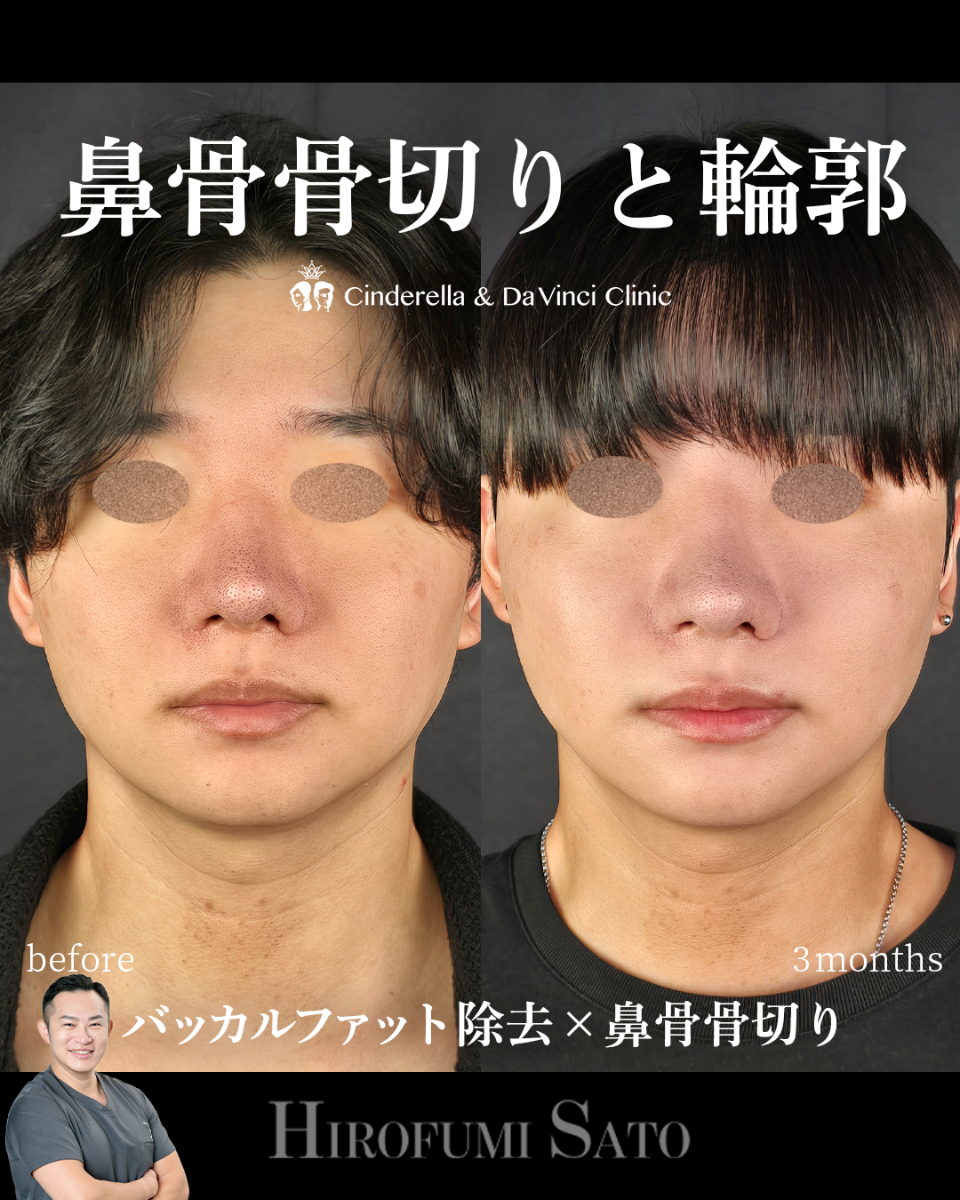 スッキリとした顔立ちへの画像