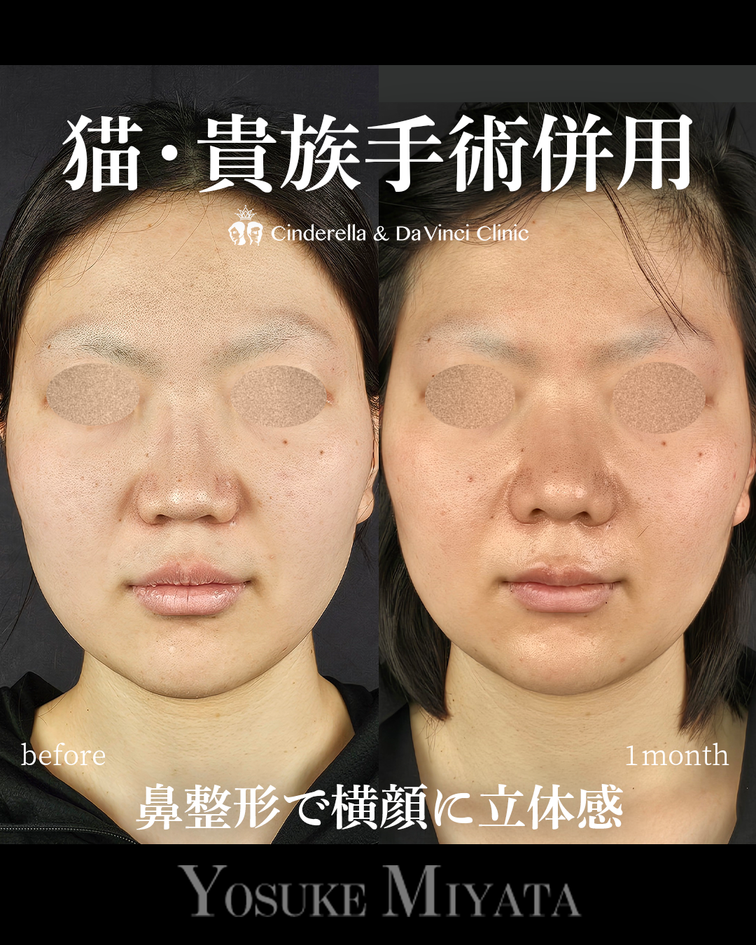 横顔に立体感を出すの画像