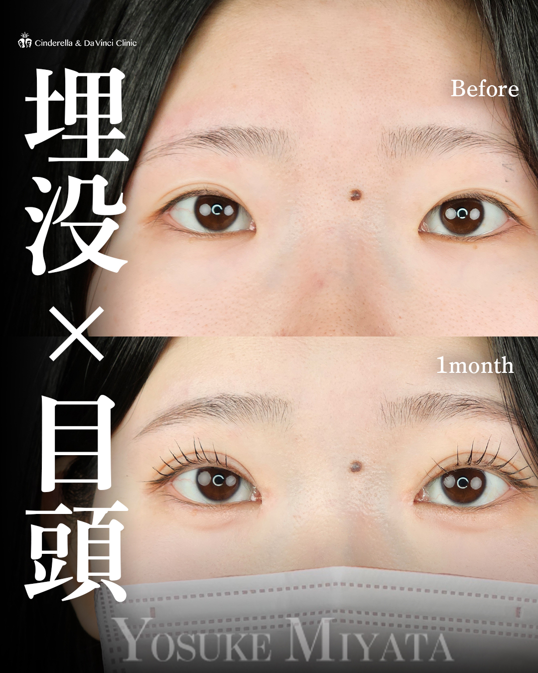 より大きいお目元へ