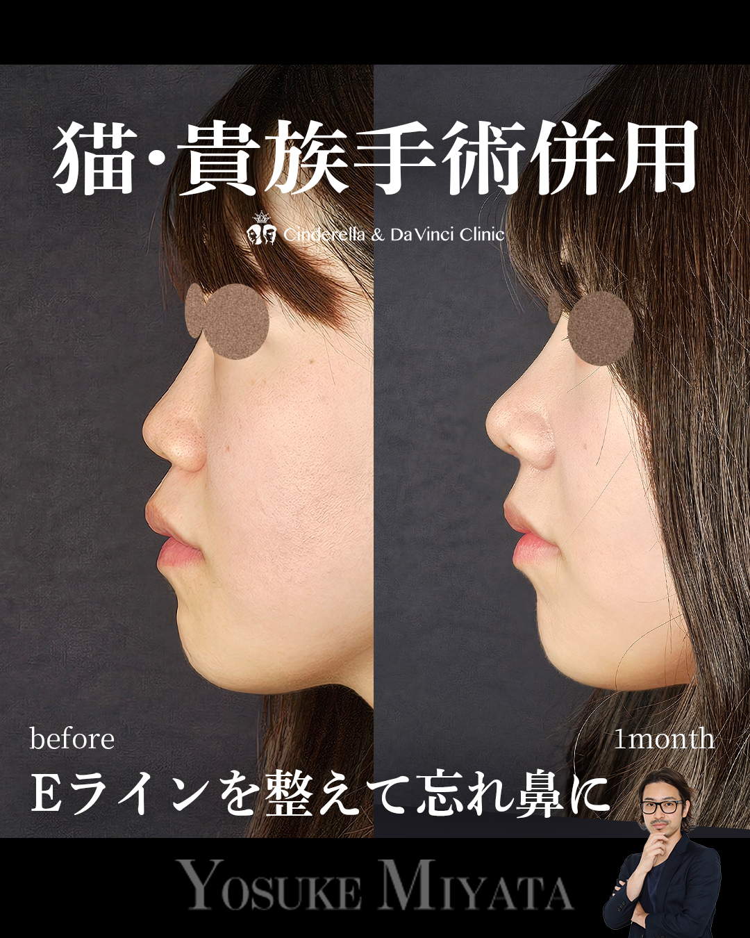 Eライン美しく