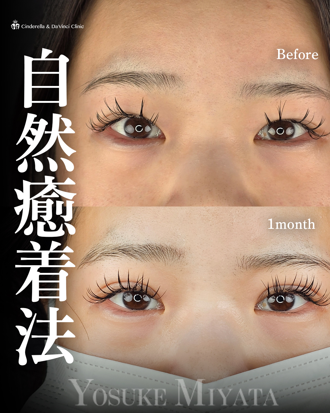 長いまつ毛が映える二重