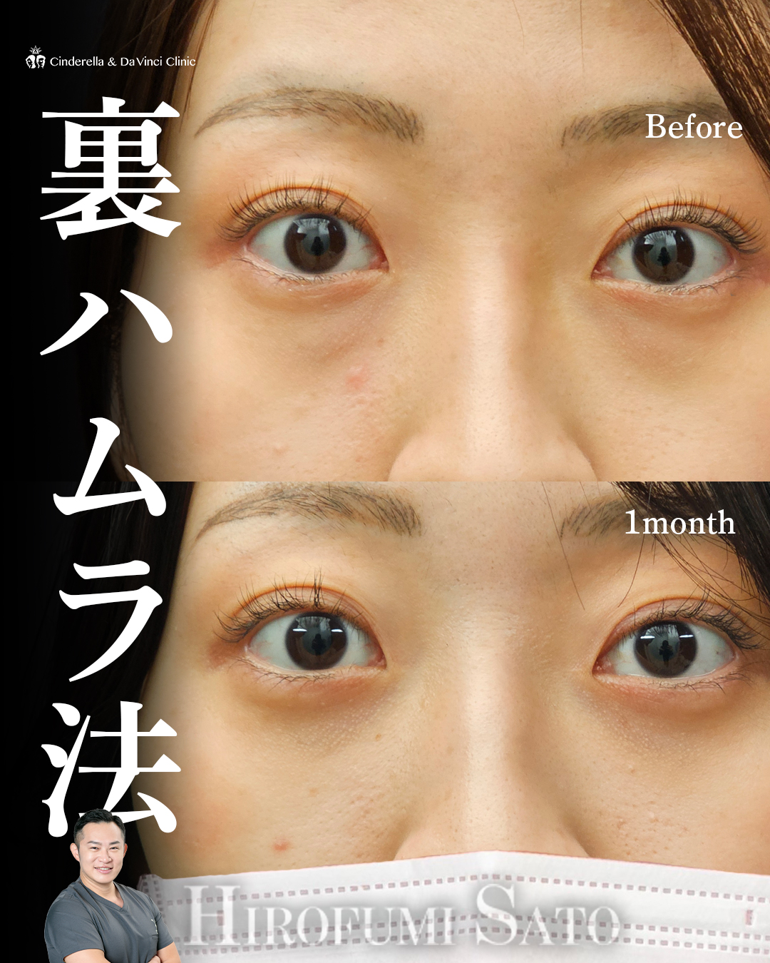 どんより目元卒業