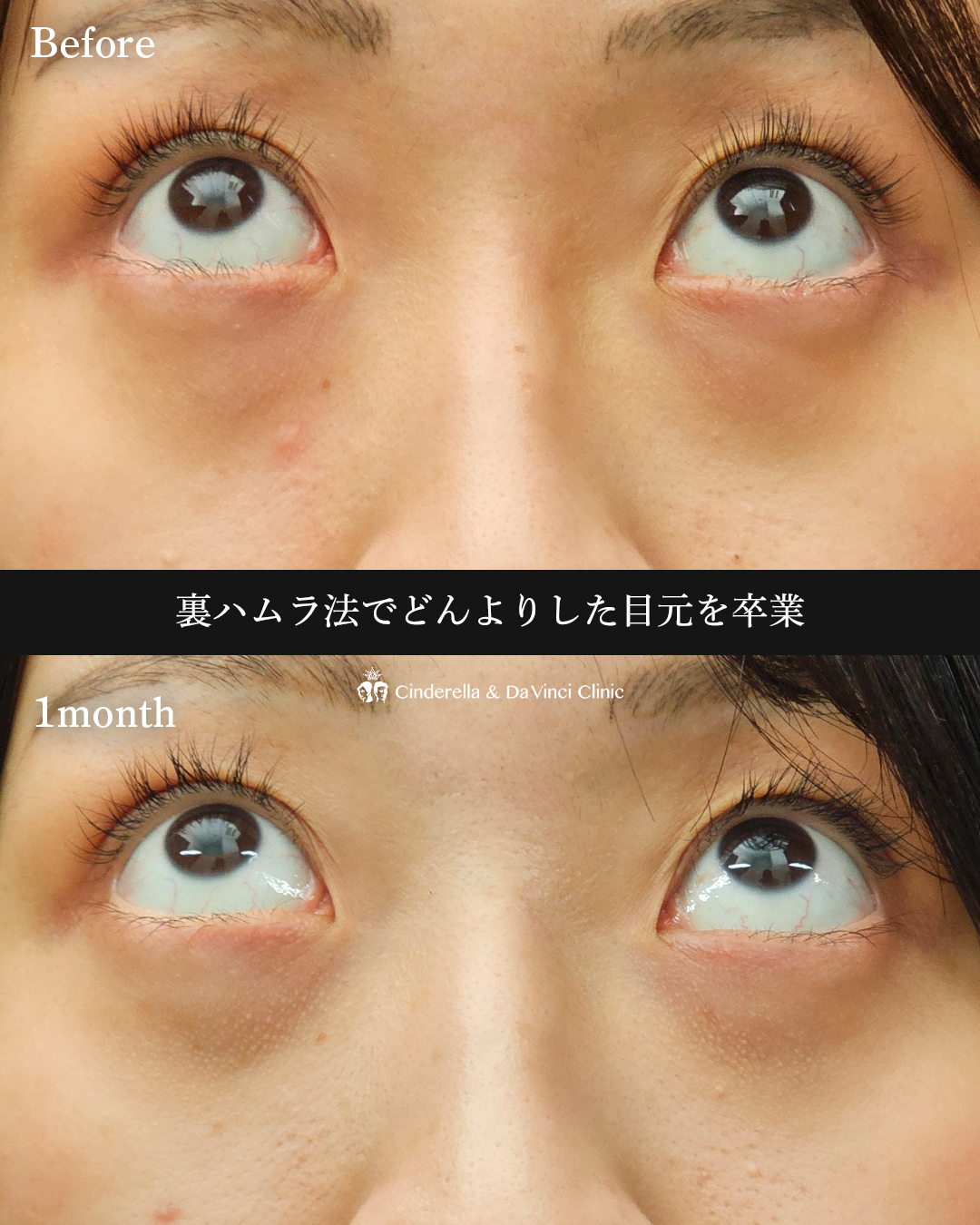 どんより目元卒業の画像