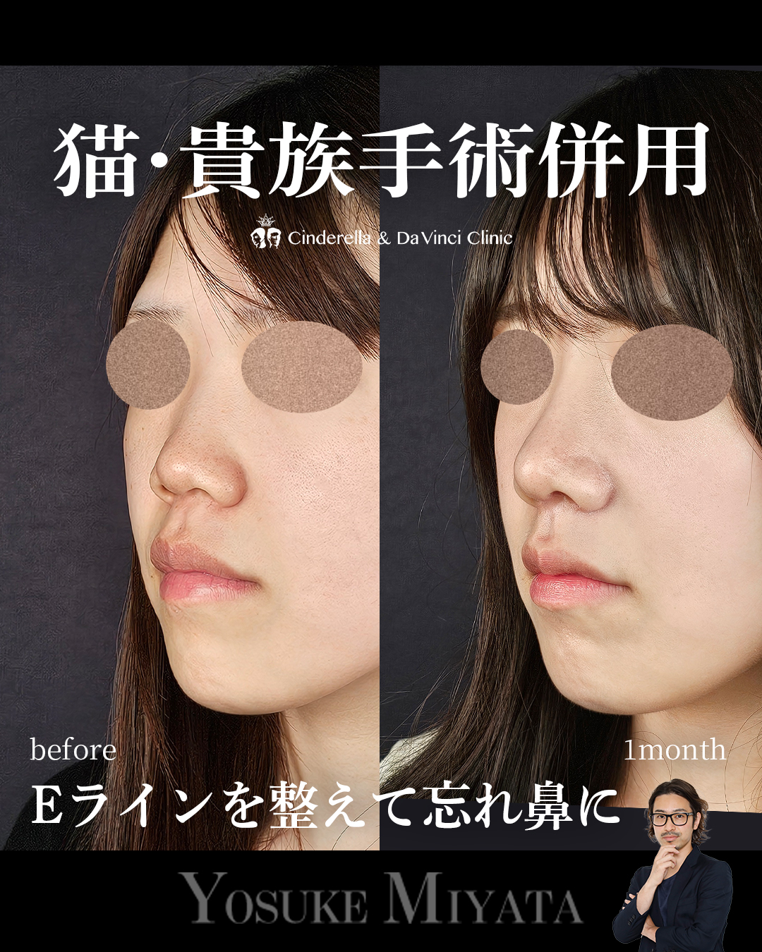 Eライン美しくの画像
