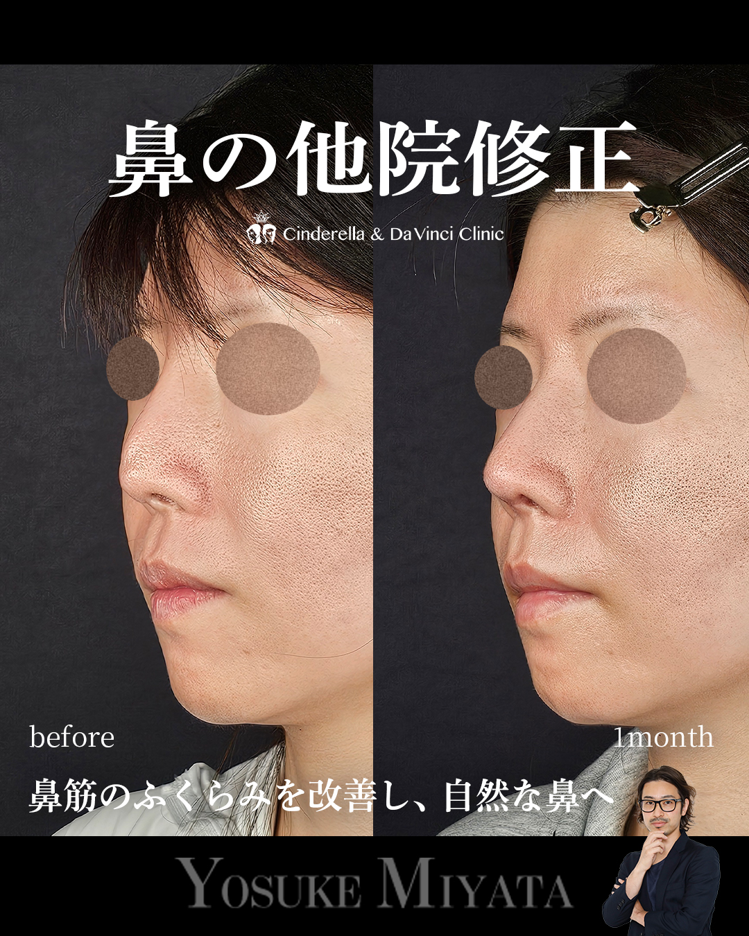 他院修正の画像