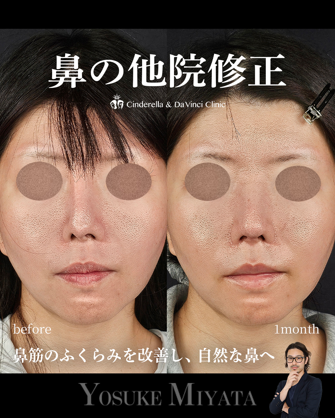 他院修正の画像