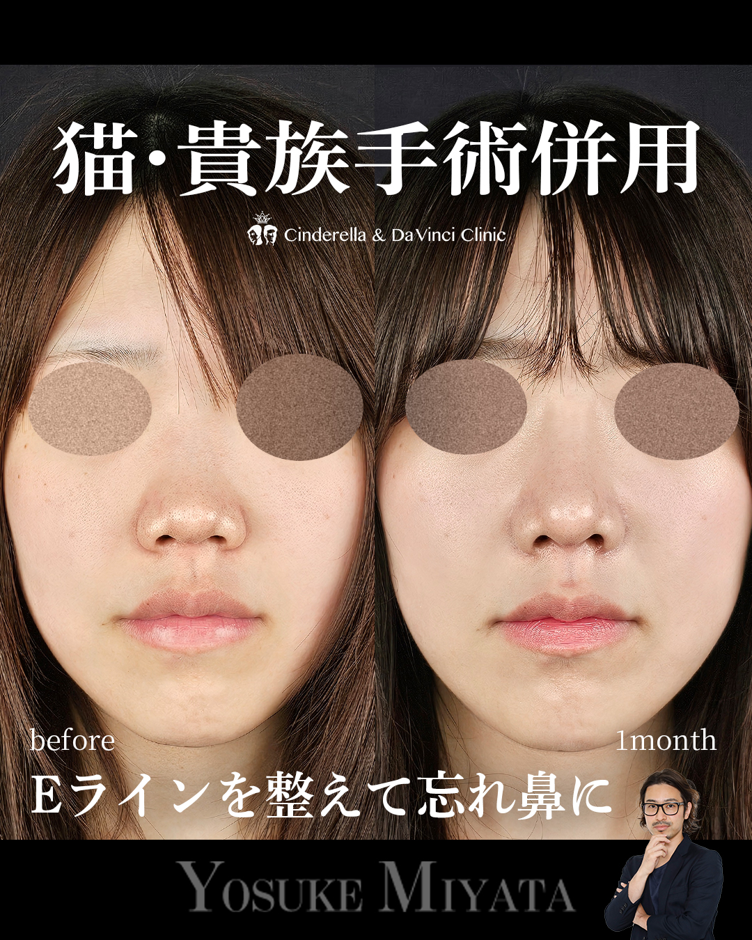 Eライン美しくの画像