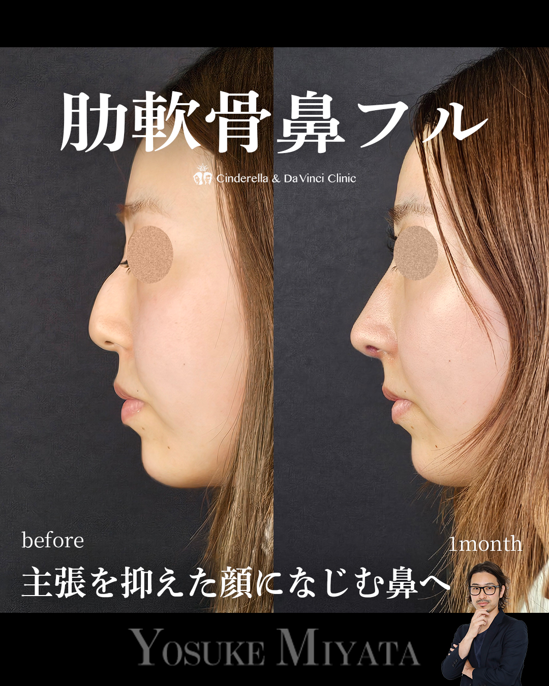 鼻の印象薄く