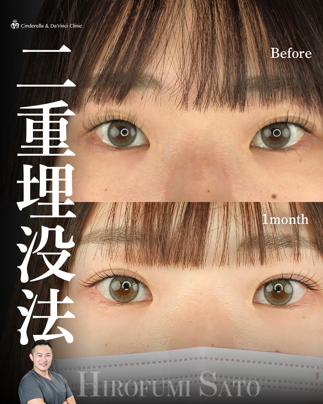 まつ毛が映える二重