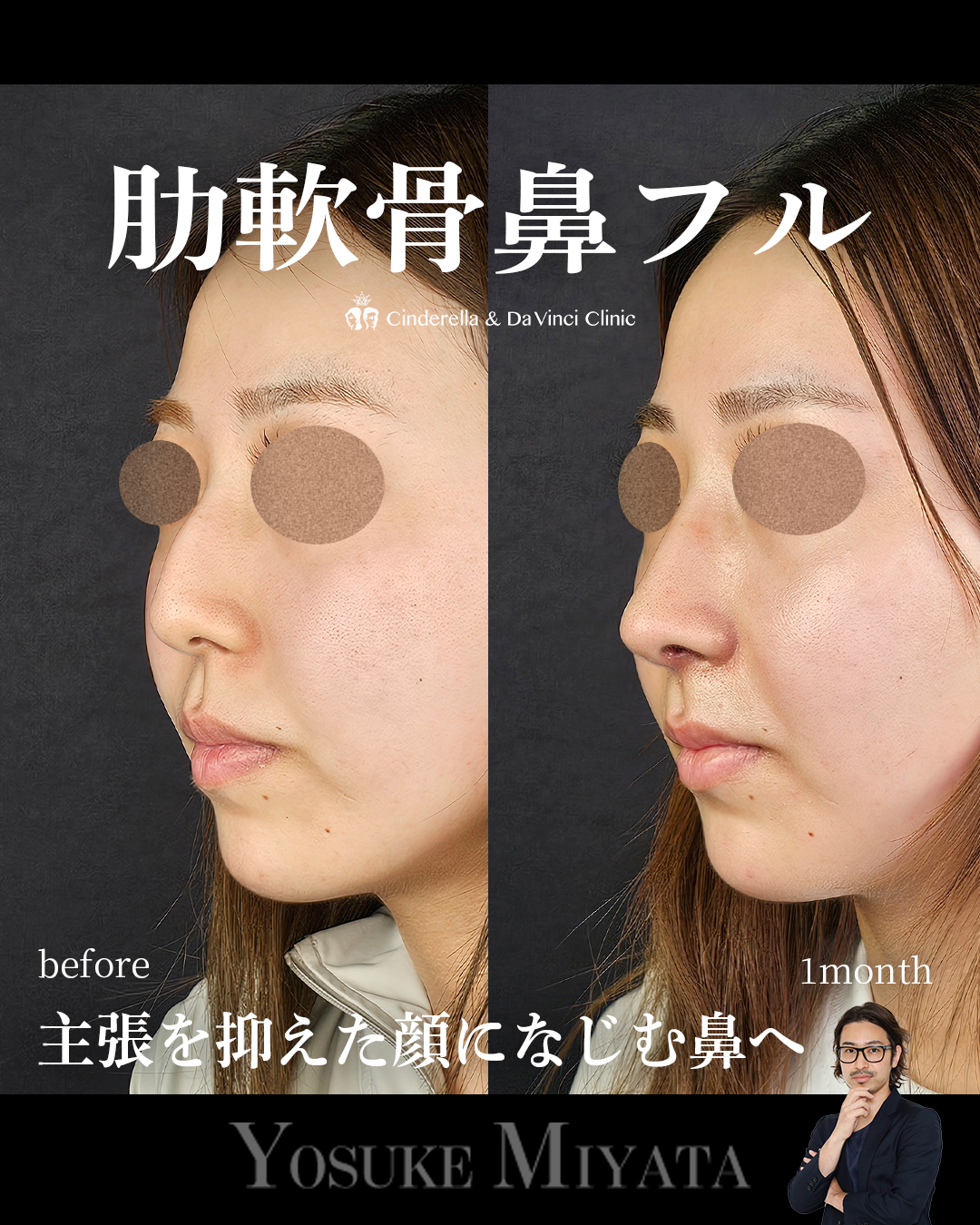 鼻の印象薄くの画像