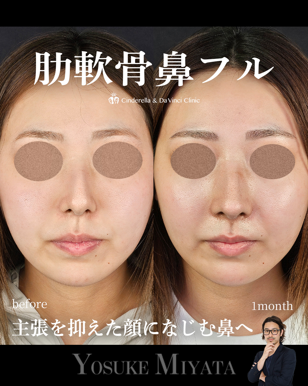 鼻の印象薄くの画像