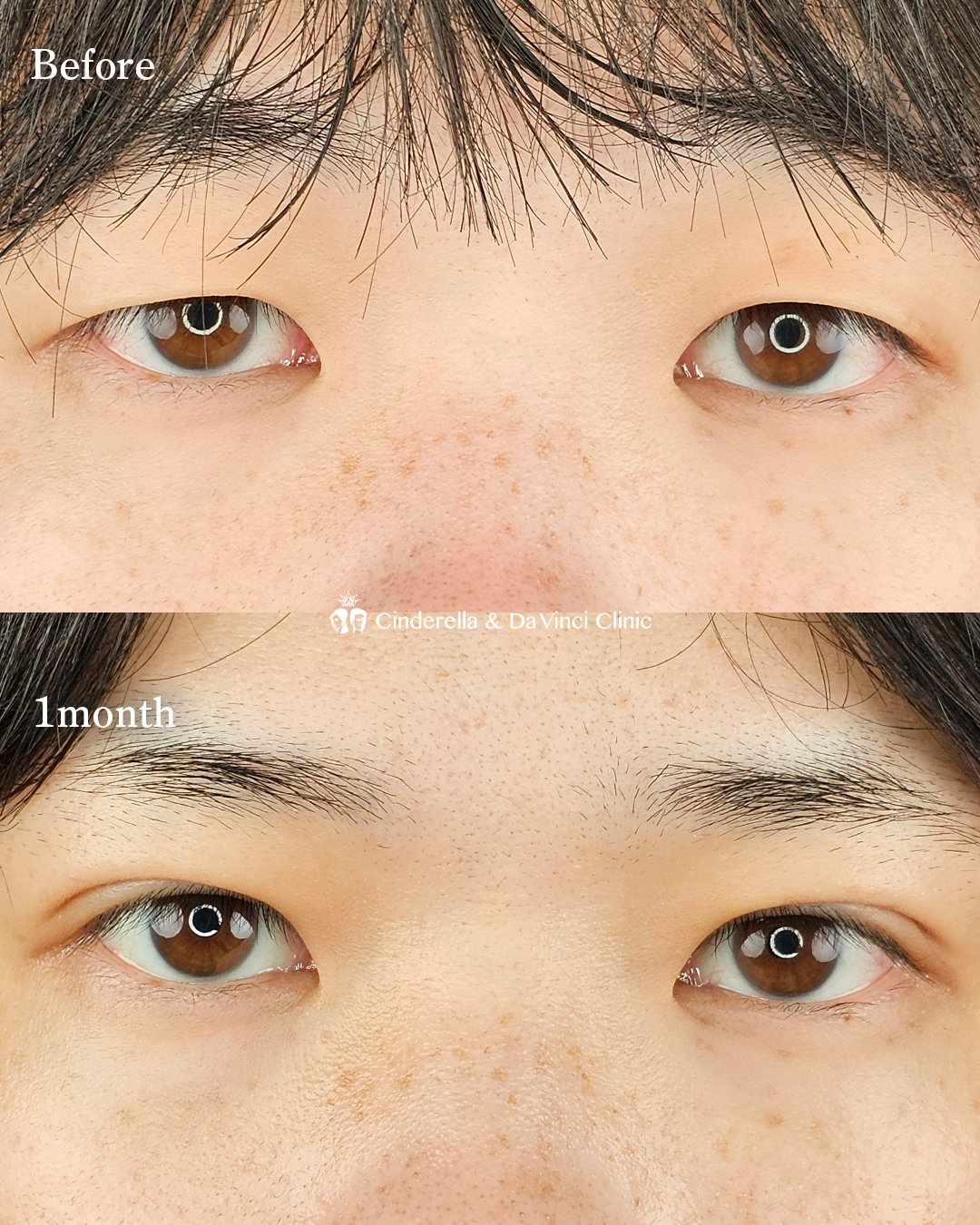 目元の印象変えるの画像