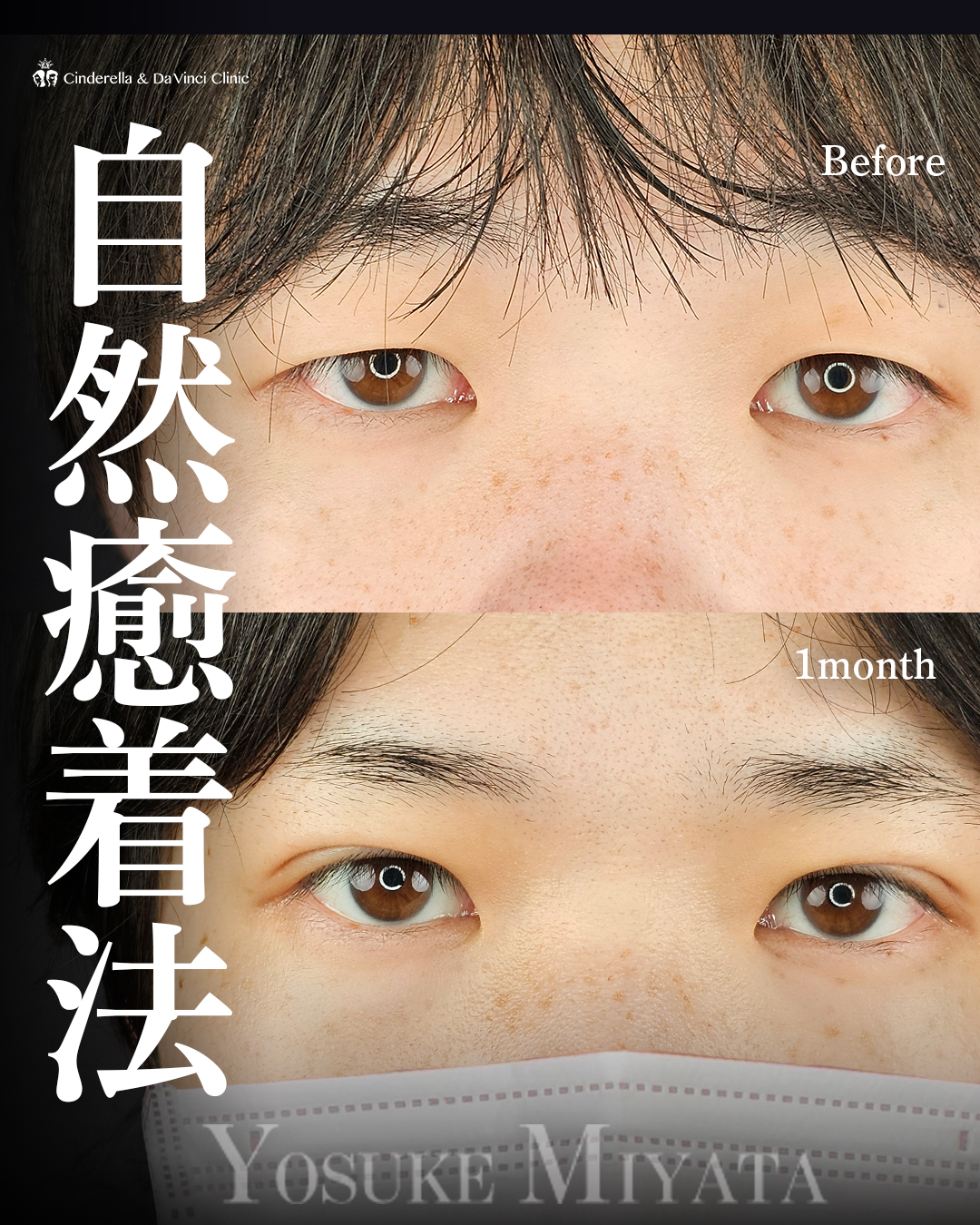 目元の印象変える