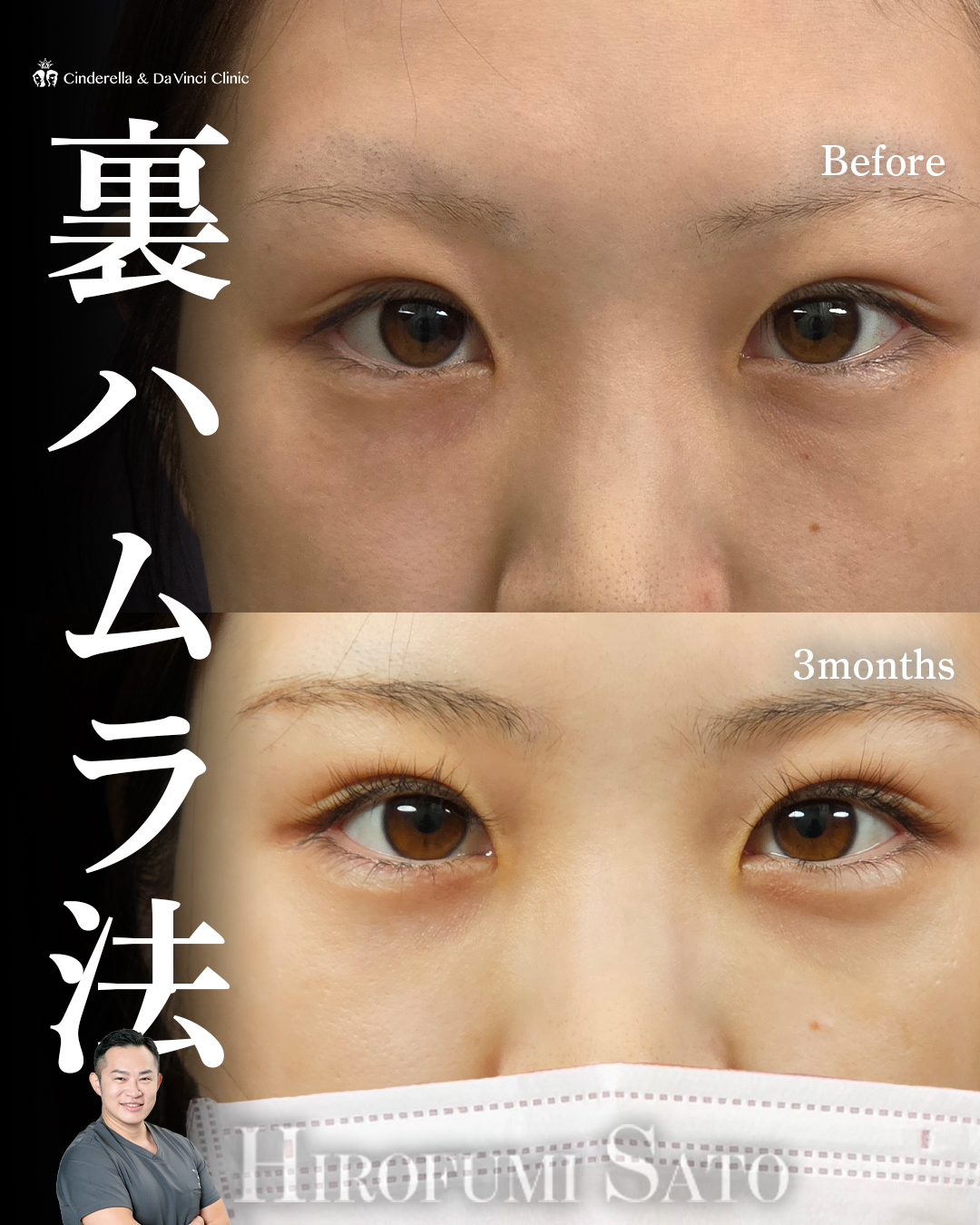明るいお目元へ