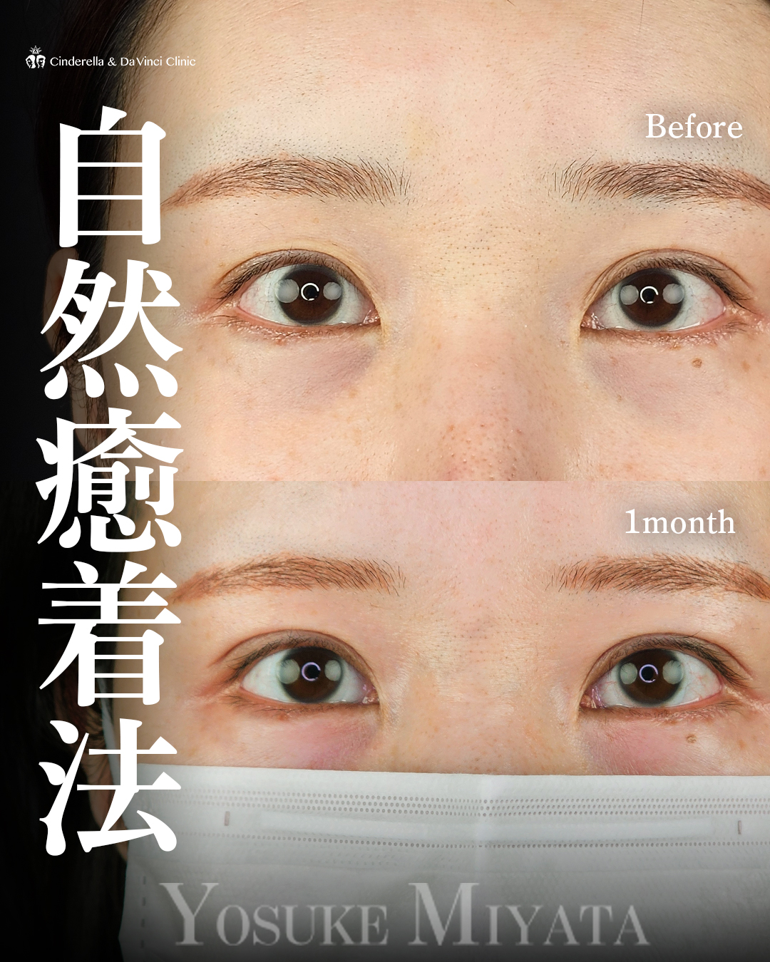 均一な二重