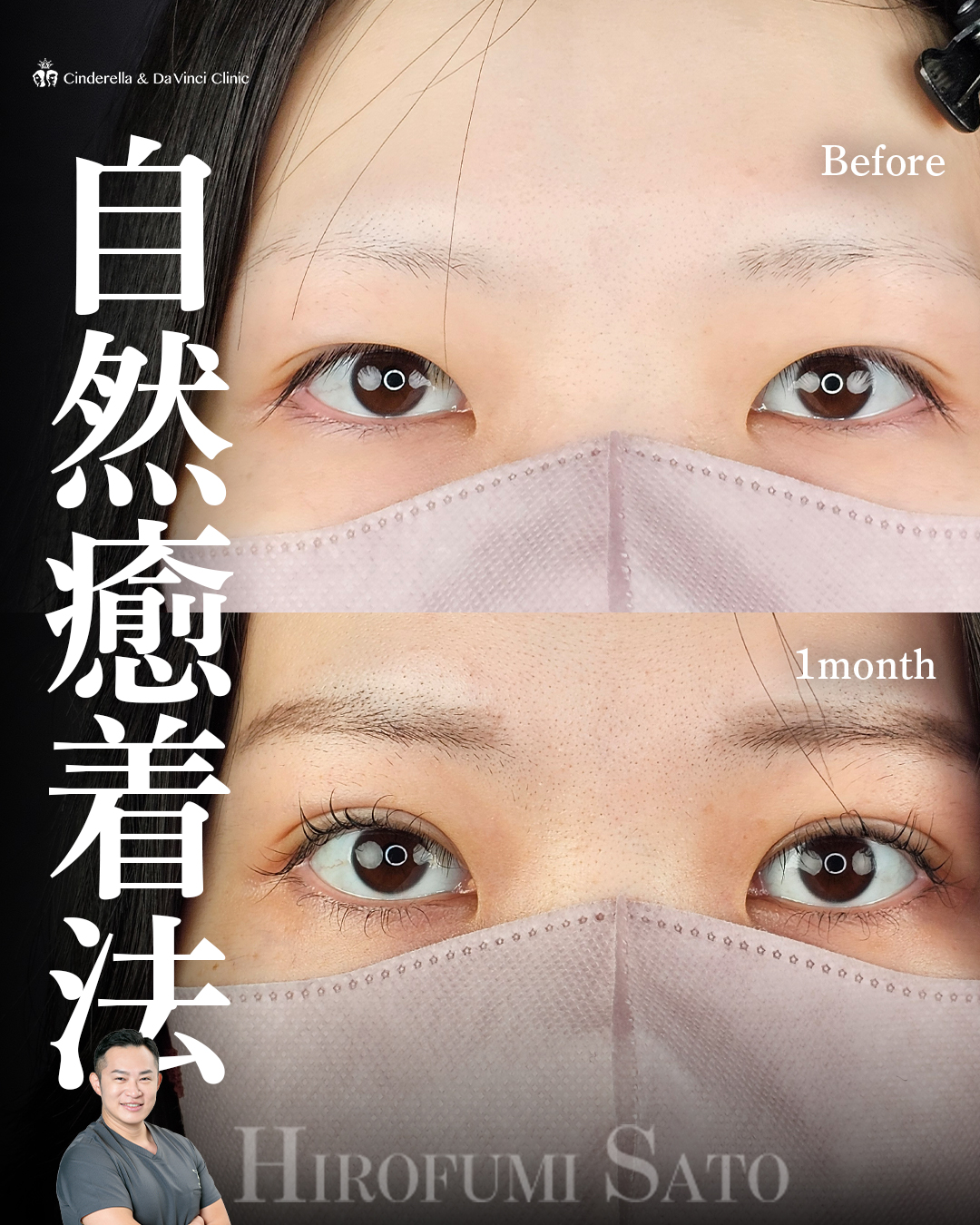 まつ毛が映える二重