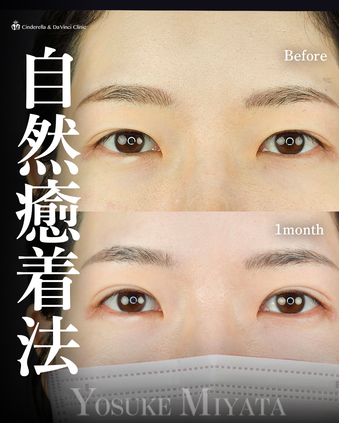 自然に幅を広げる