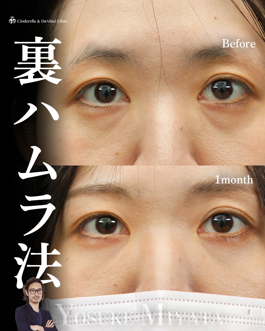 疲れ見え解消