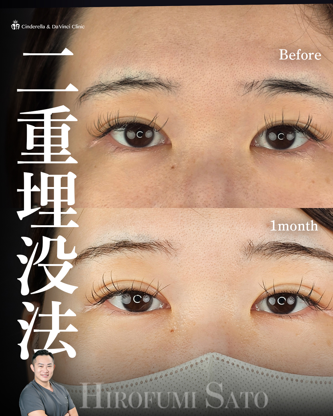 まつ毛が映える二重