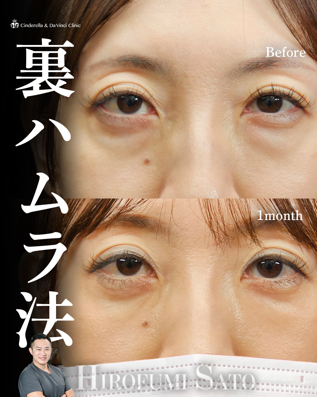 すっきりとした目元へ