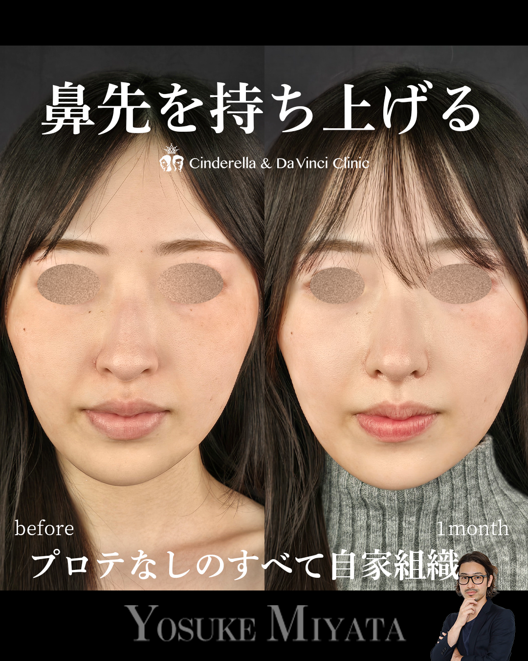 鼻先を持ち上げるの画像