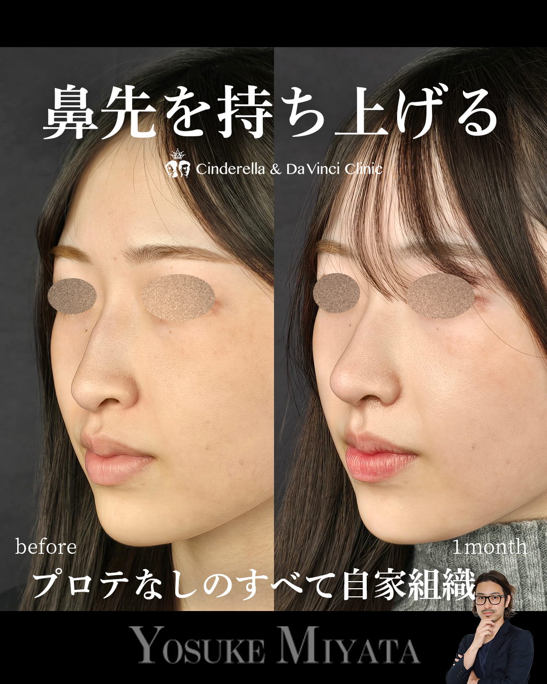 鼻先を持ち上げるの画像