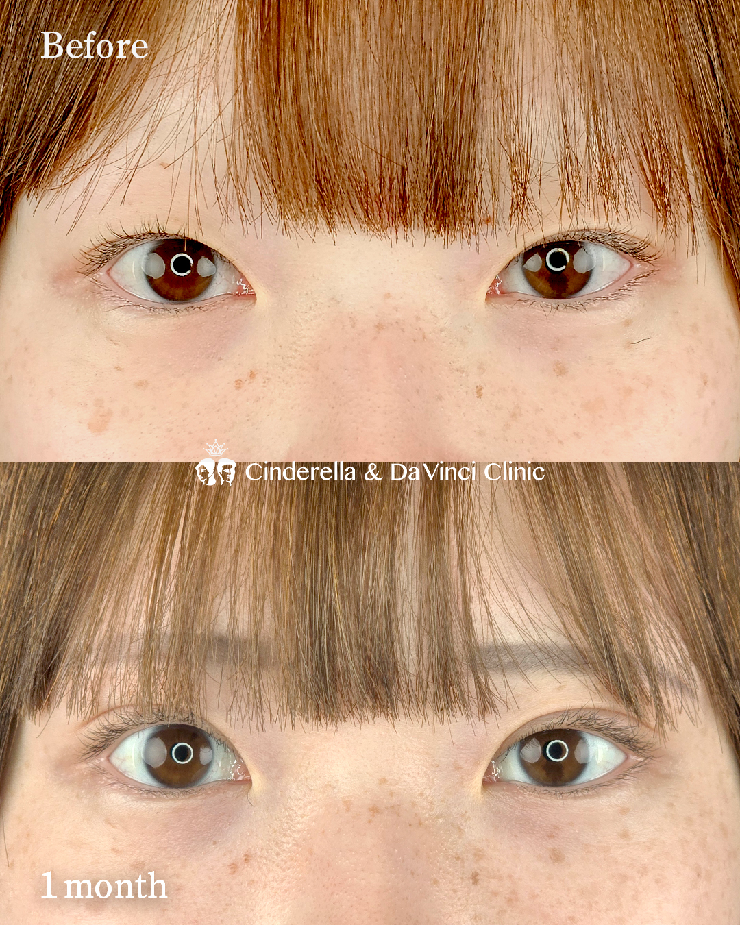 二重で目の印象をやわらかくの画像