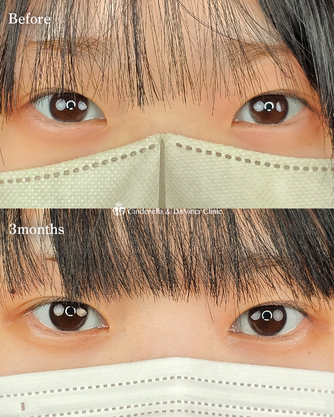 自然に目を大きくの画像