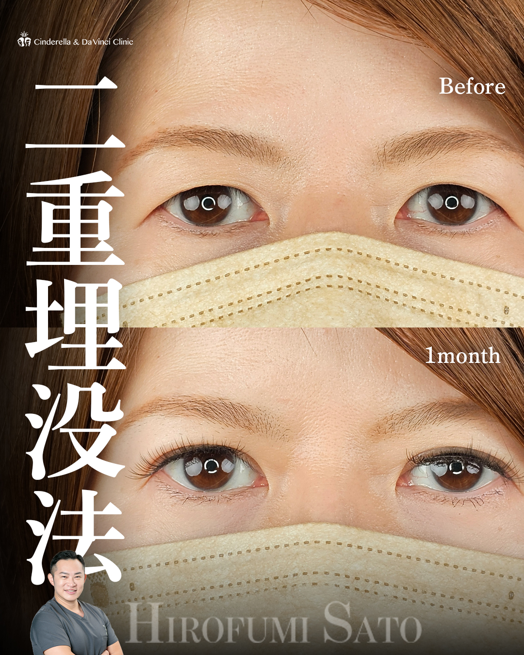 華やかな二重へ