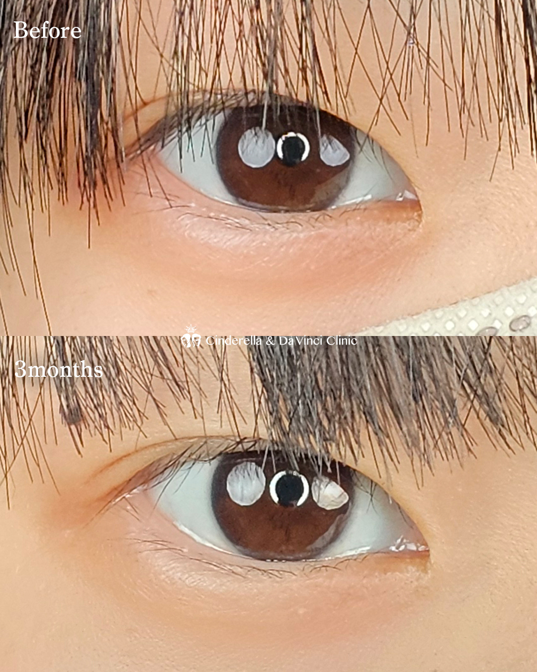 自然に目を大きくの画像