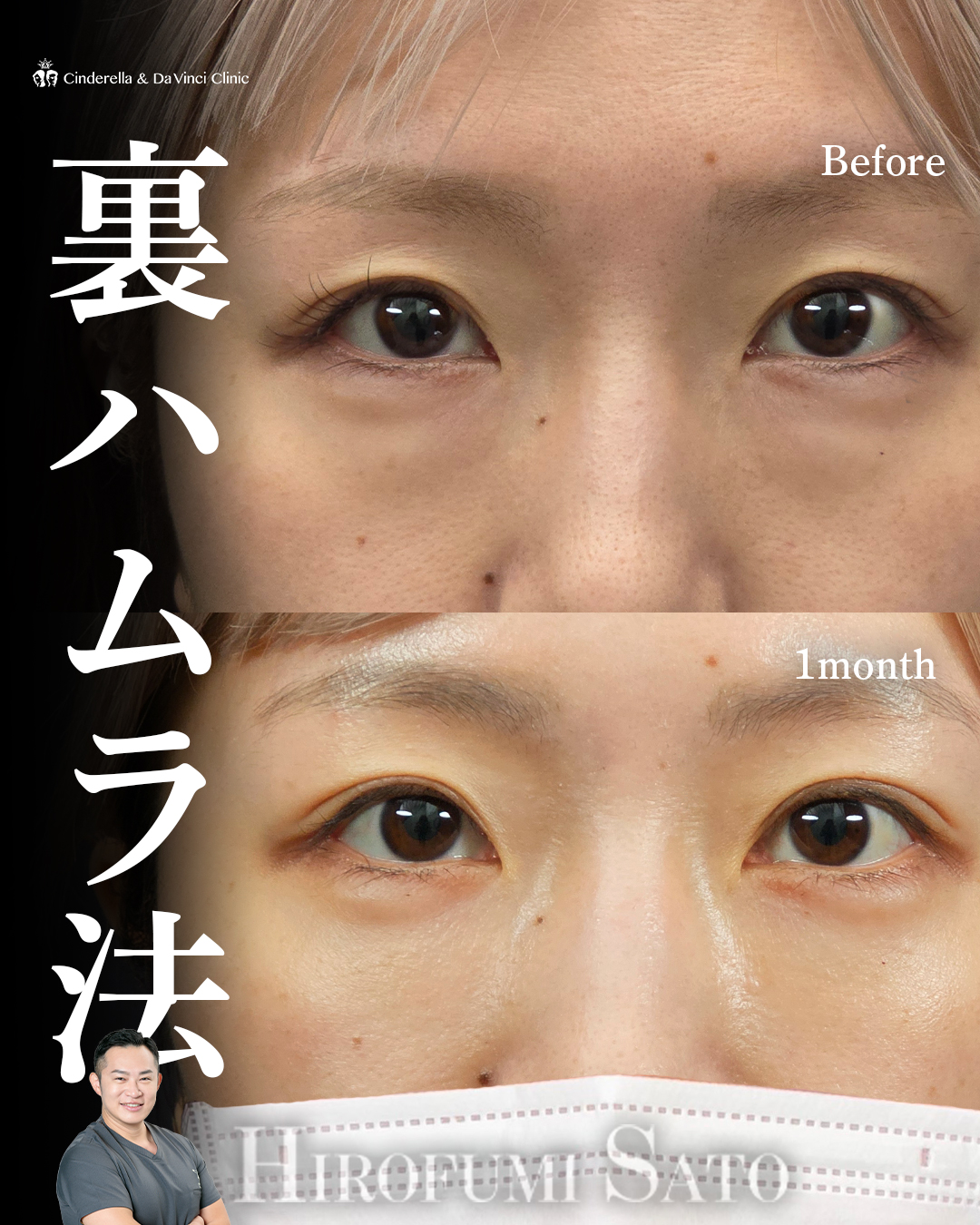 疲れ顔を卒業