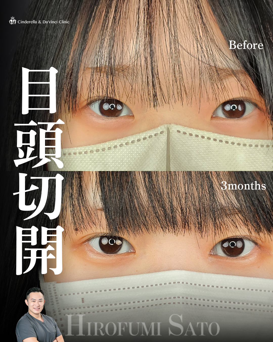 自然に目を大きく